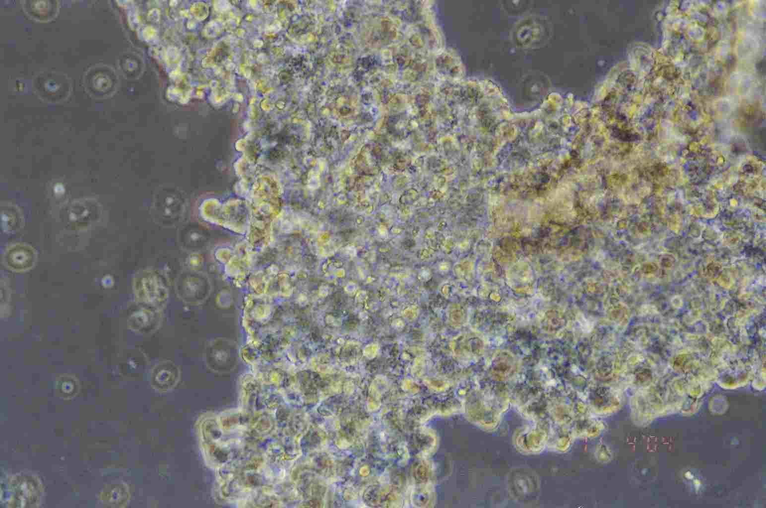 NCI-H209细胞图片