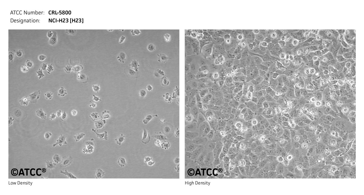 NCI-H23细胞图片