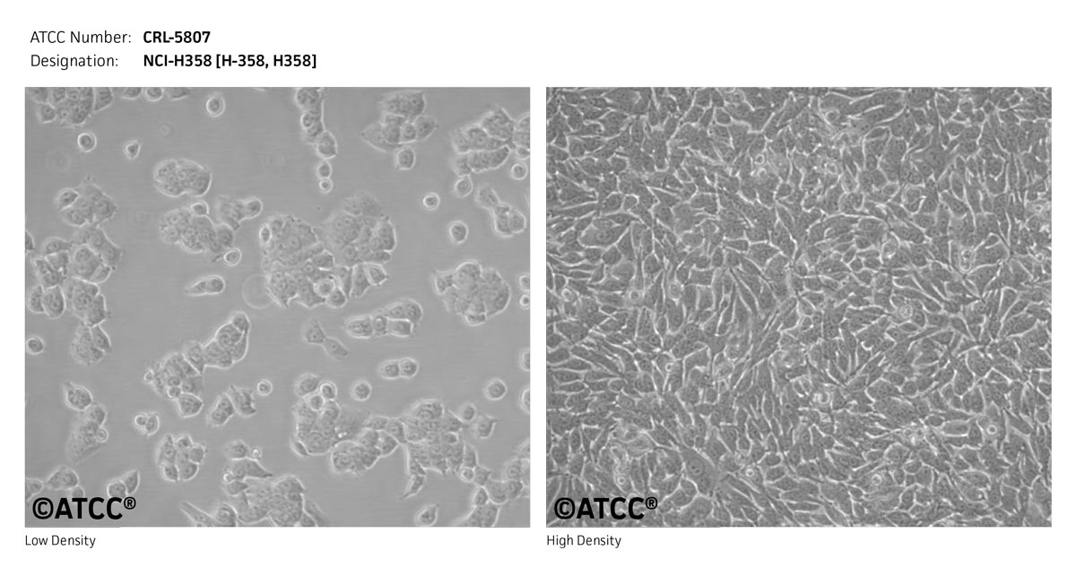 NCI-H358细胞图片
