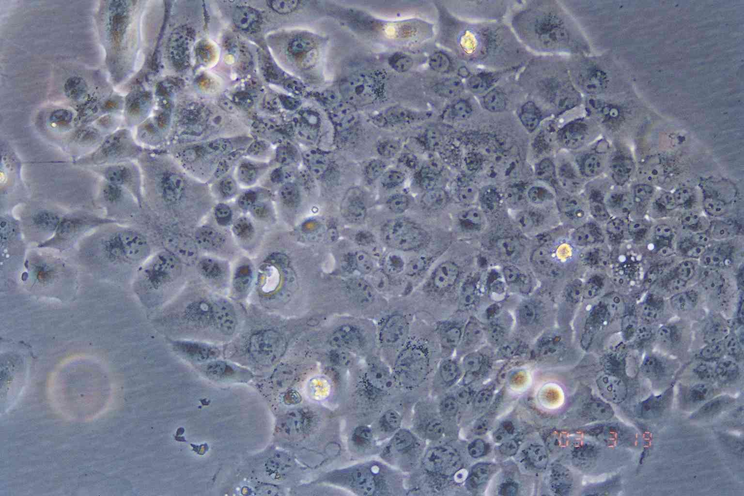 NCI-H441细胞图片