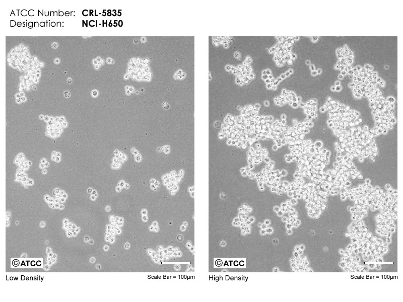 NCI-H650细胞图片