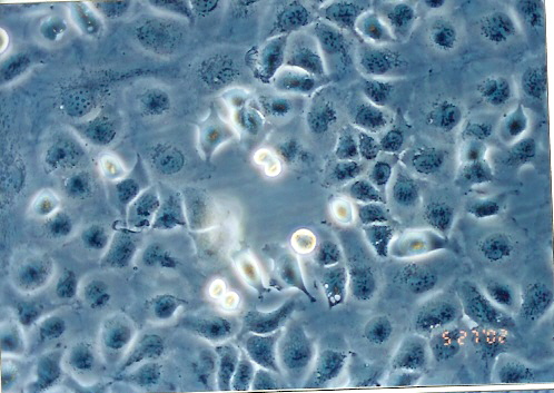 NCI-H661细胞图片