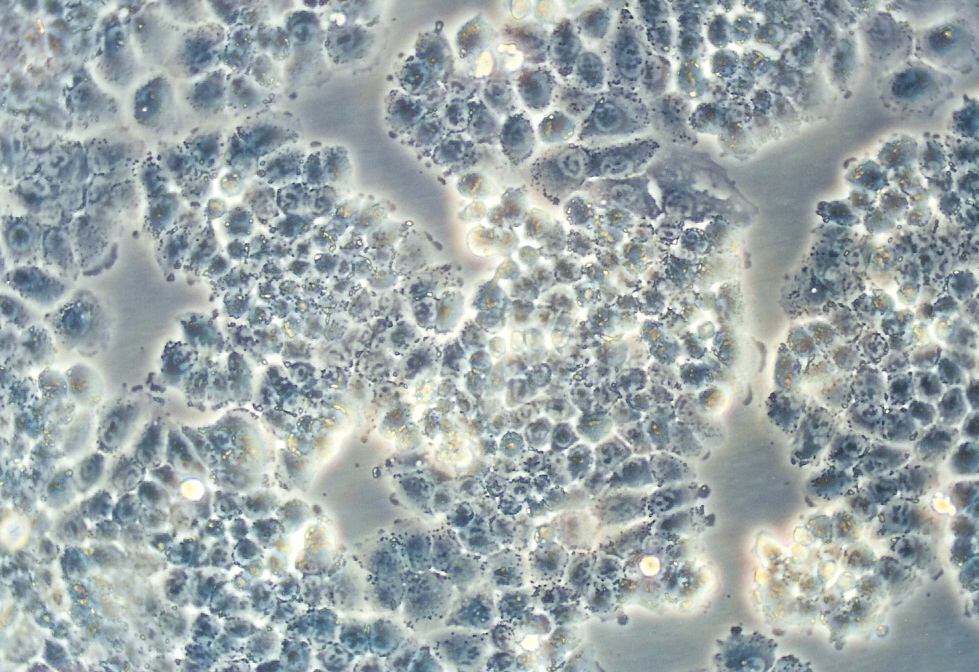 NCl-H460细胞图片