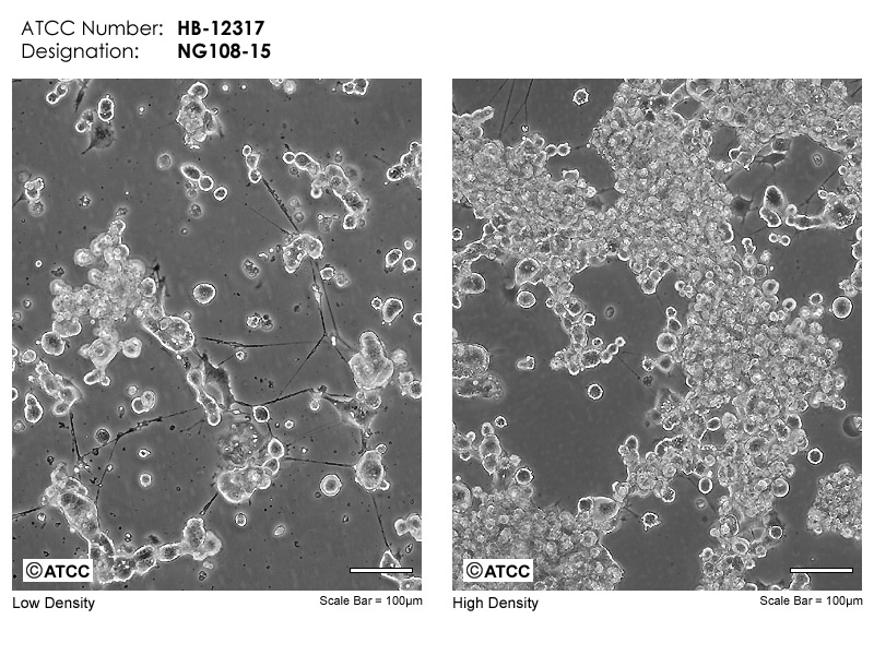 NG108-15细胞图片