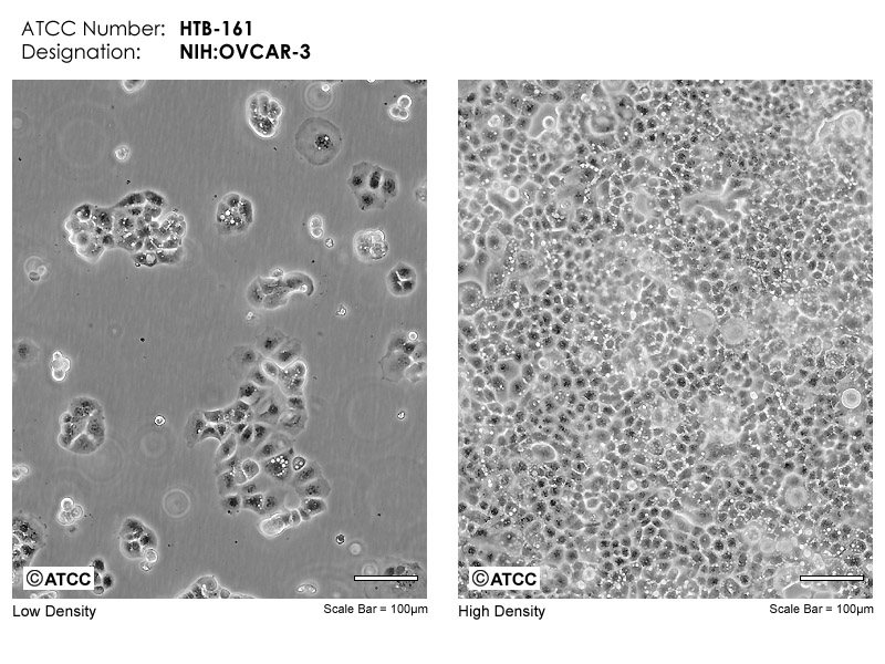 NIH:OVCAR-3细胞图片