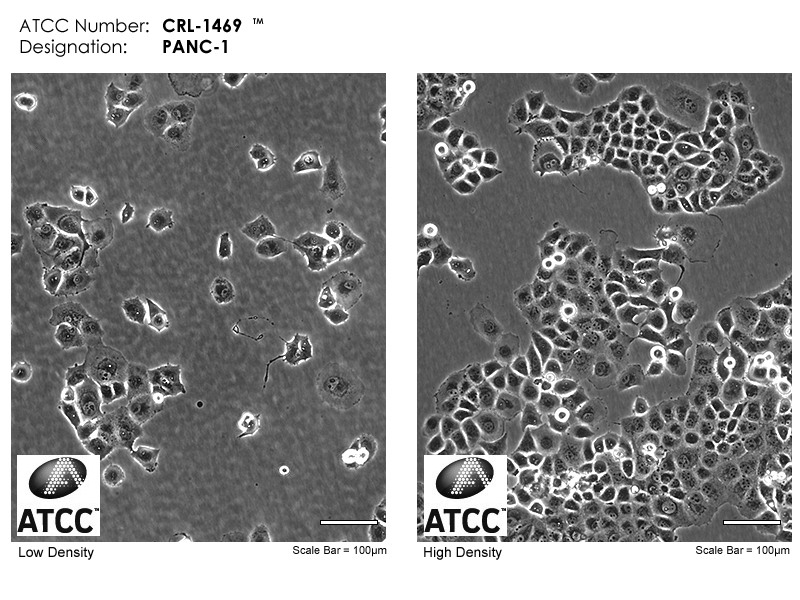 PANC-1细胞图片