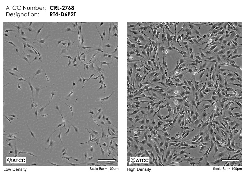 RT4-D6P2T细胞图片