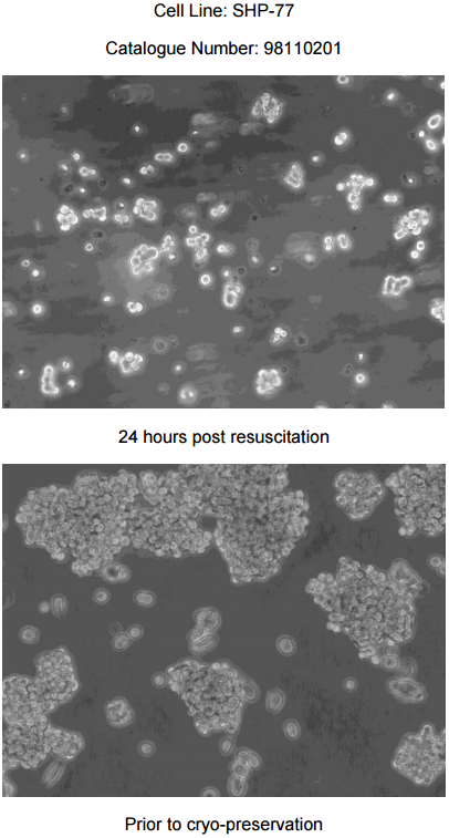 SHP-77细胞图片