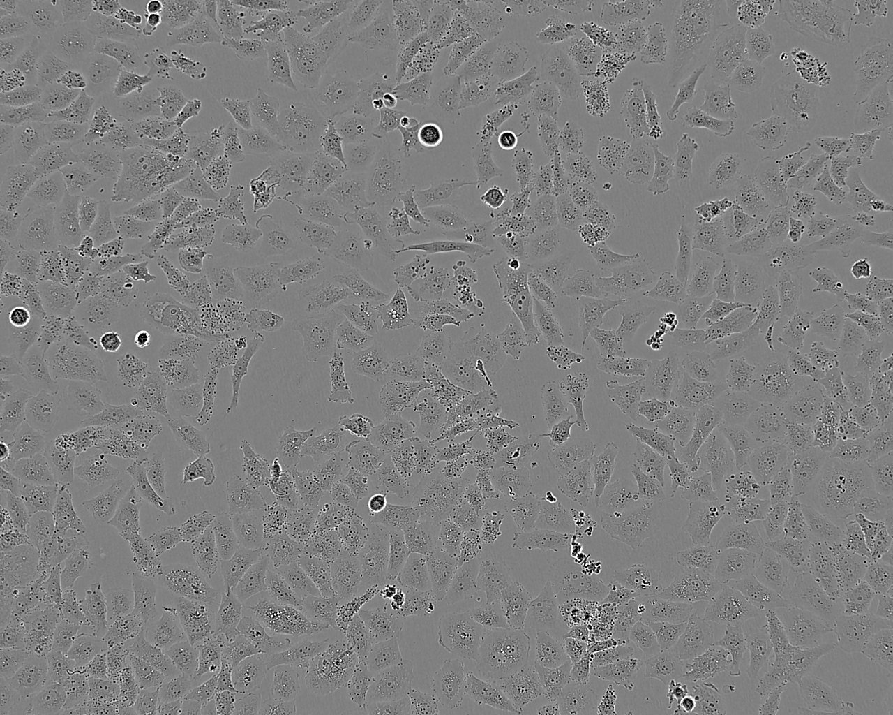 SK-LU-1细胞图片