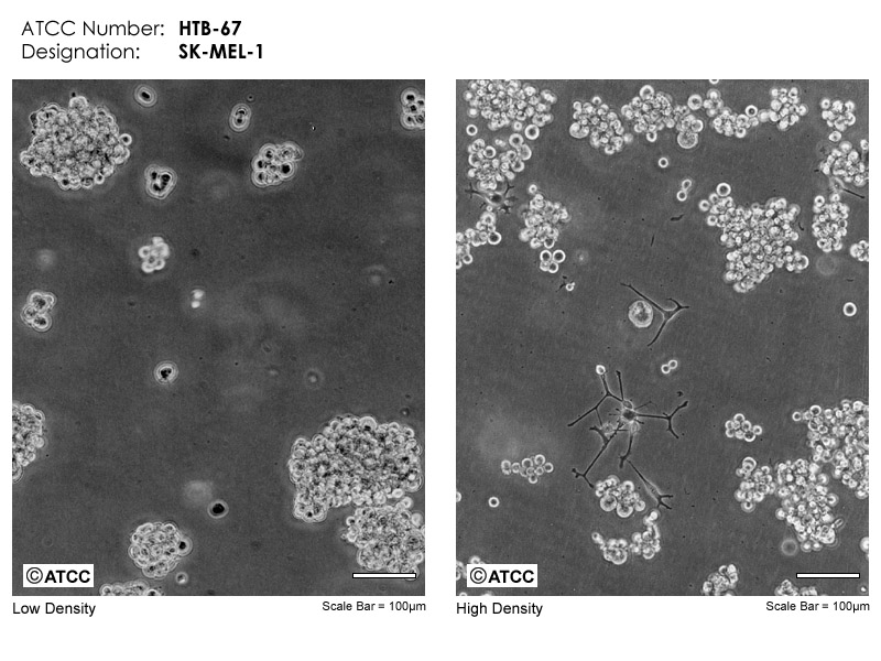 SK-MEL-1细胞图片