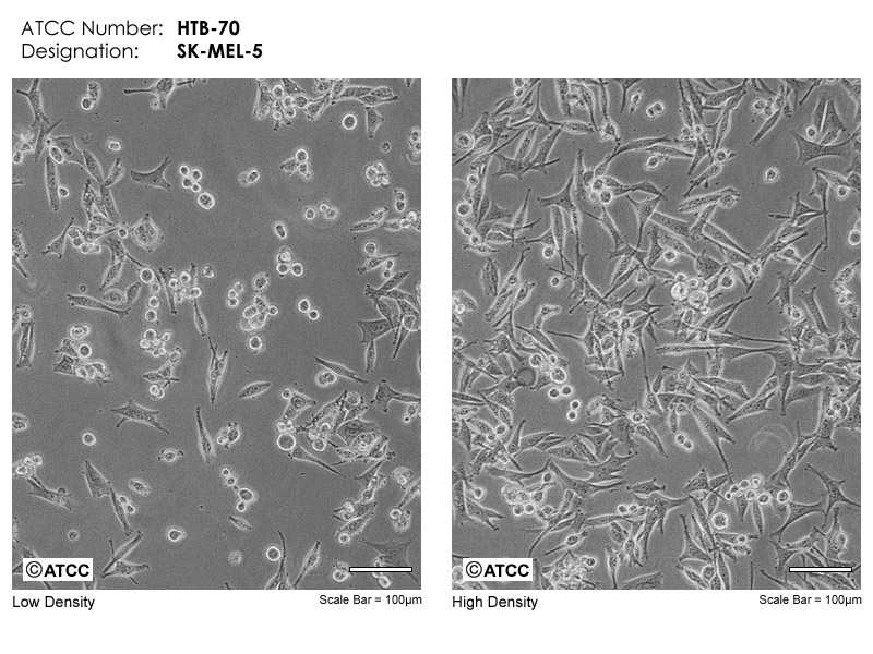 SK-MEL-5细胞图片