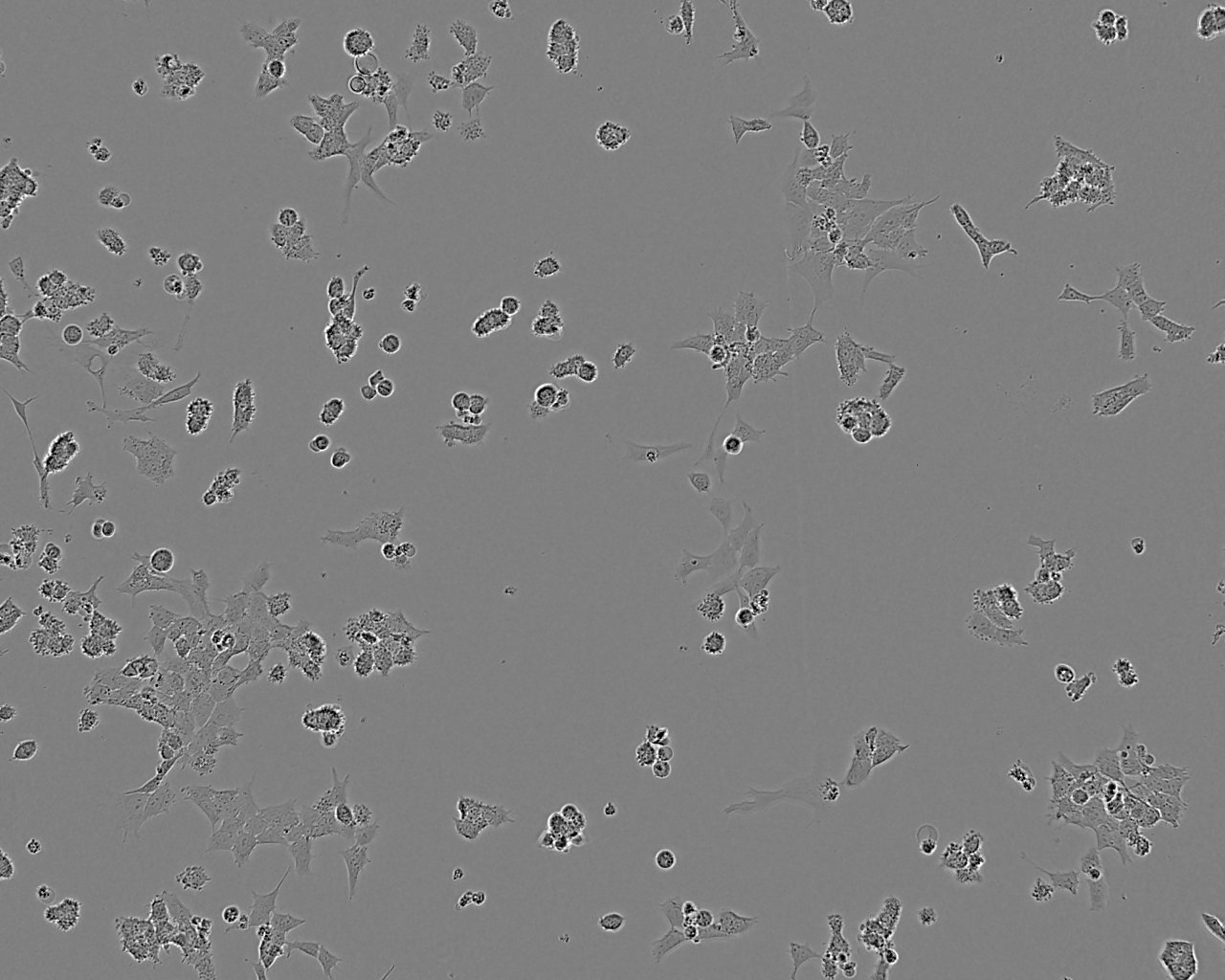 SK-N-MC细胞图片