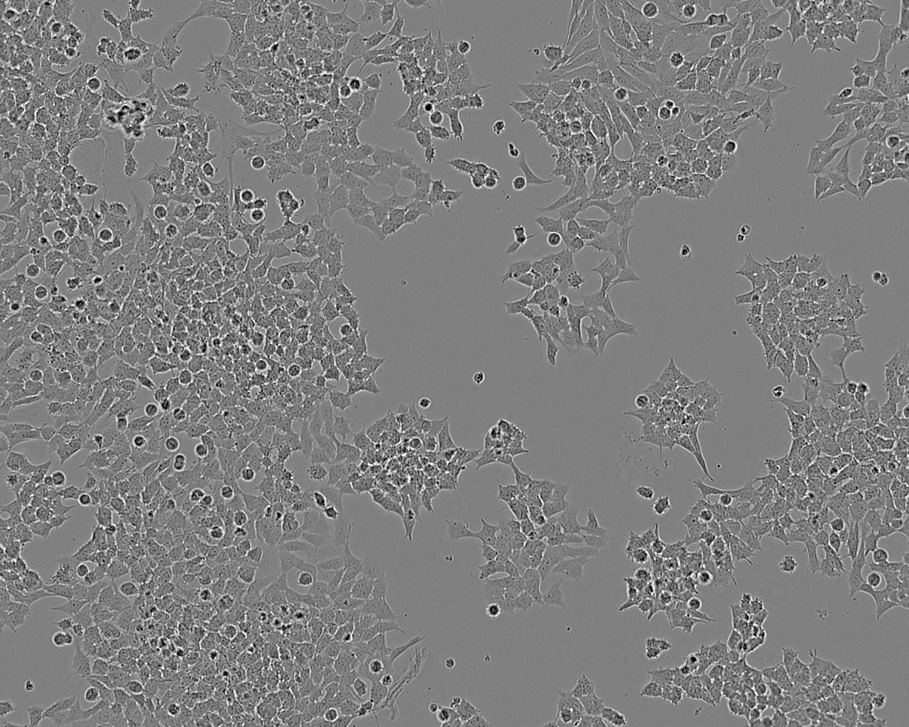 SK-N-MC细胞图片