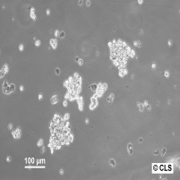 SK-NEP-1细胞图片