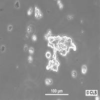 SK-NEP-1细胞图片