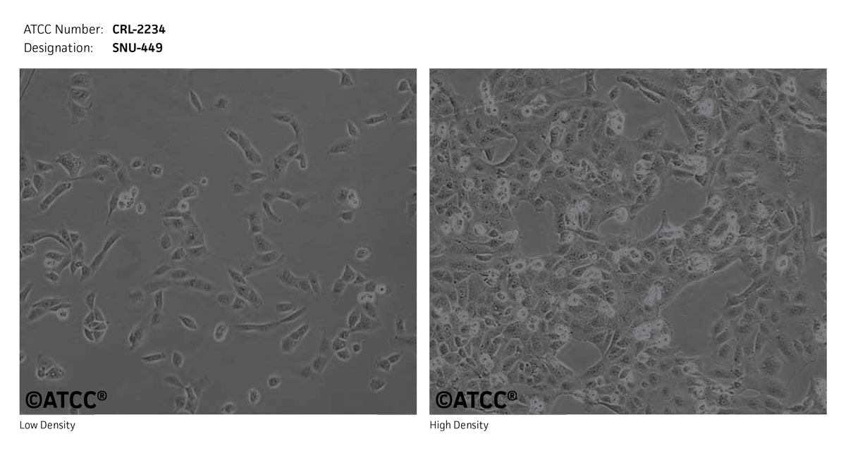 SNU-449细胞图片