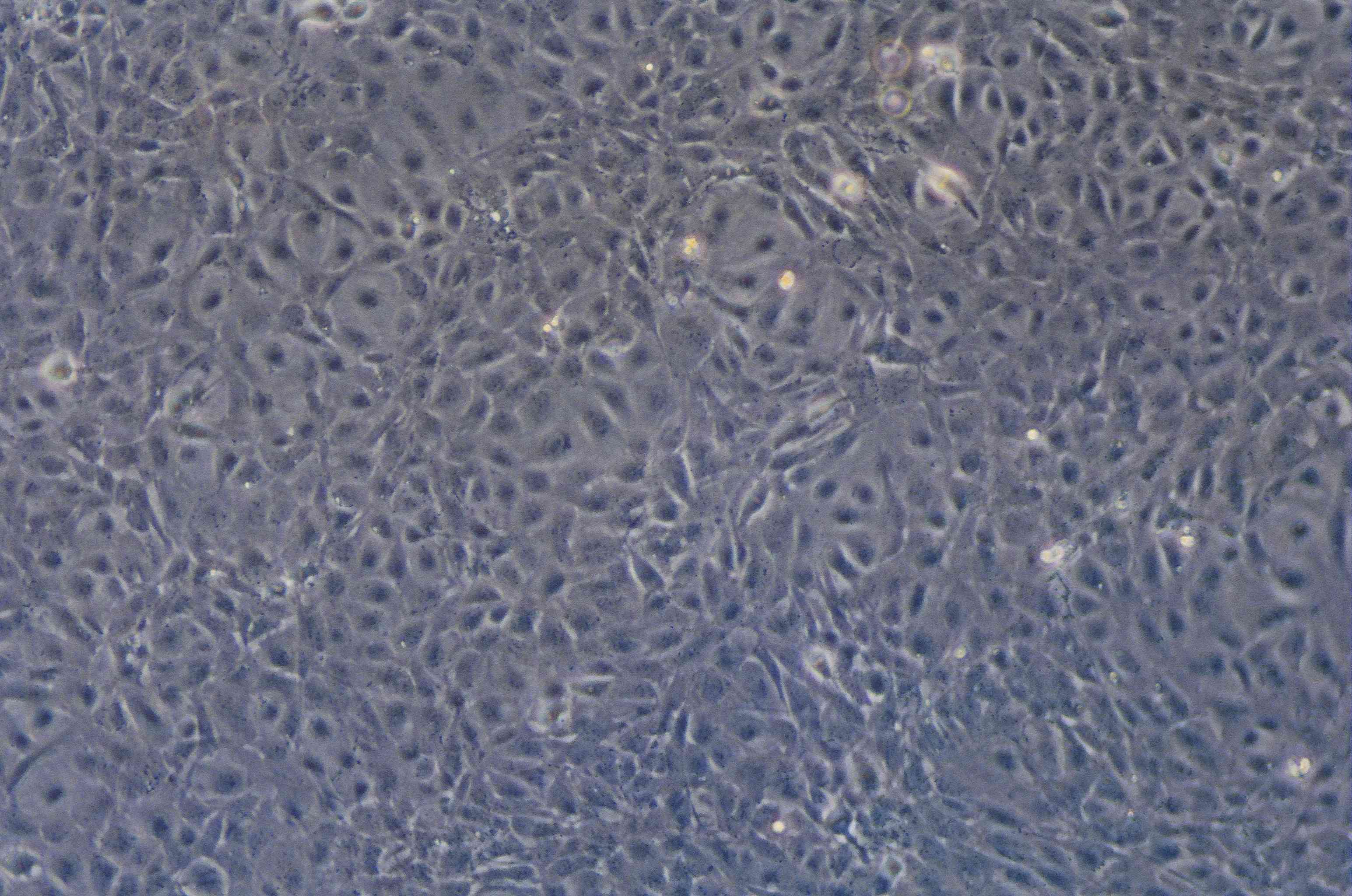 SVEC4-10细胞图片