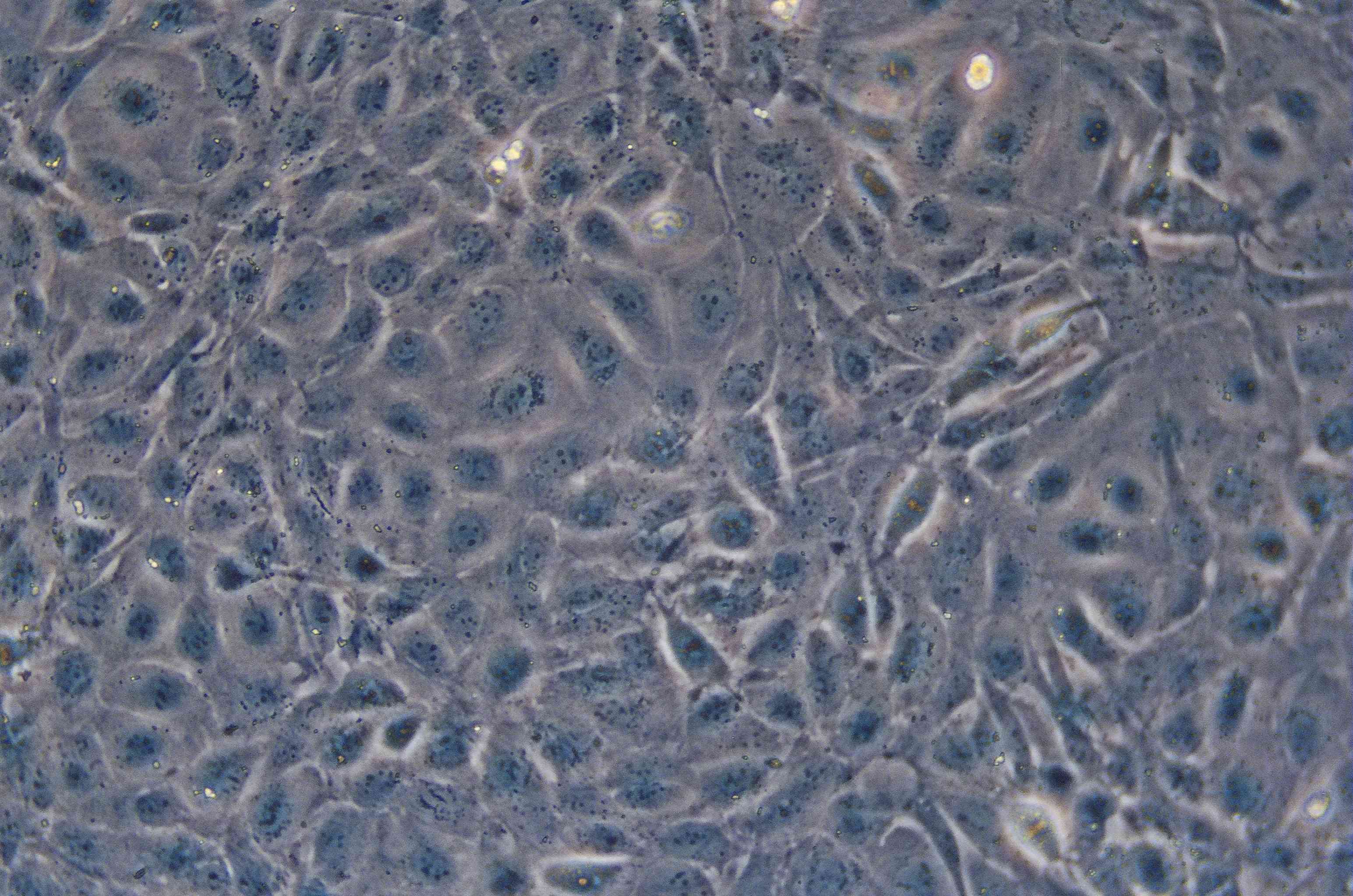 SVEC4-10细胞图片