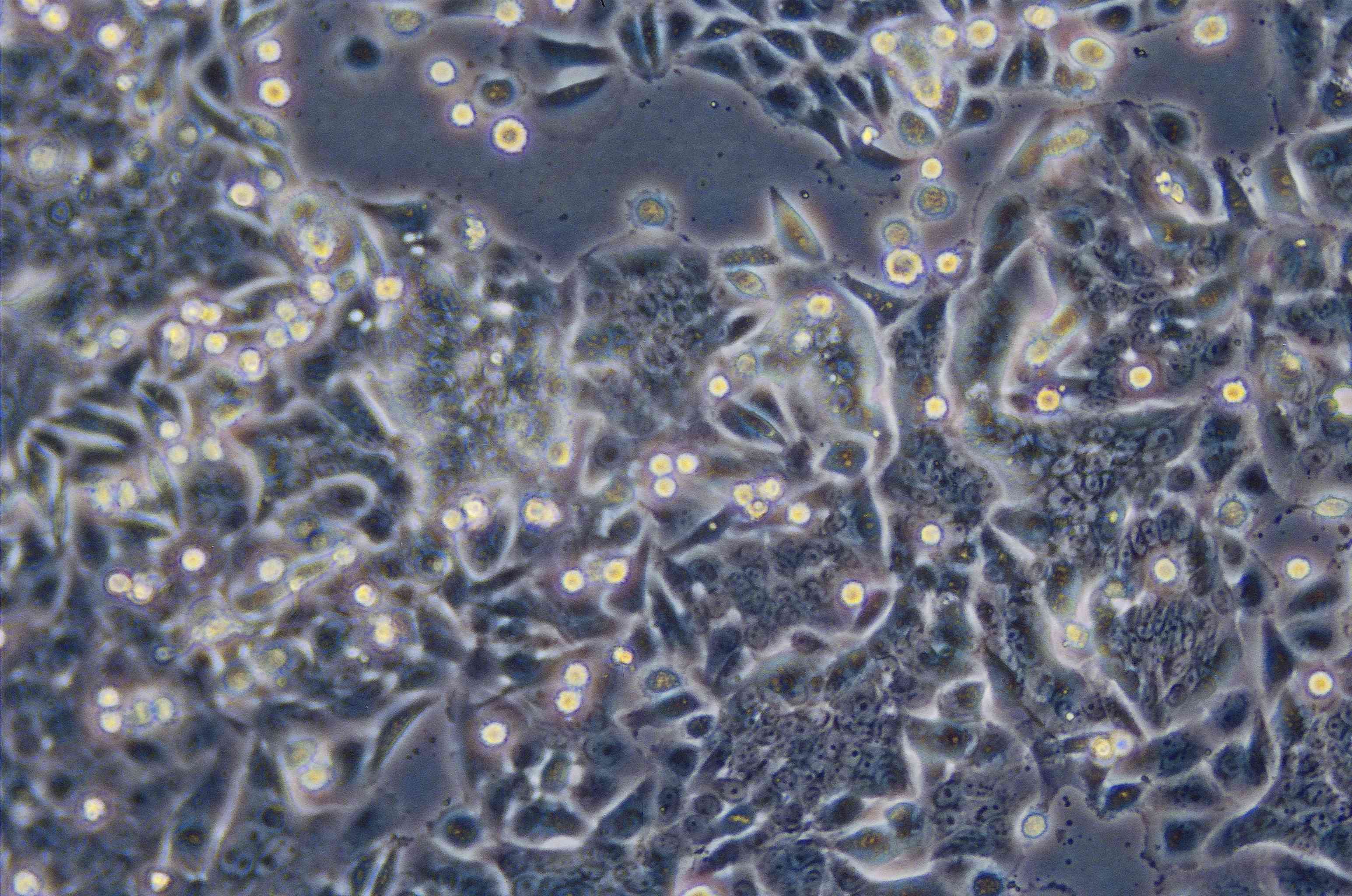 ATCC CCL-228 SW480细胞图片