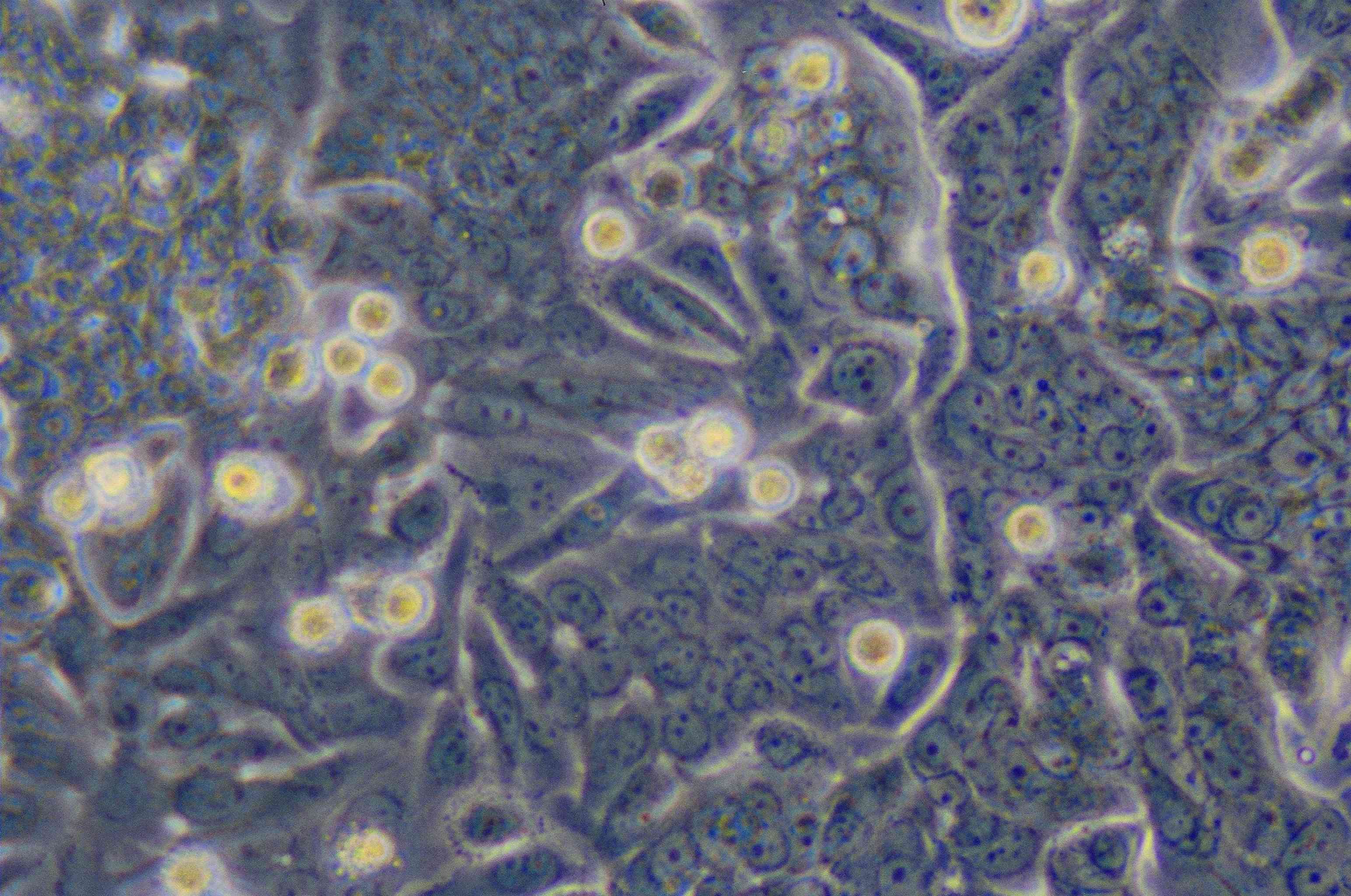 ATCC CCL-228 SW480细胞图片