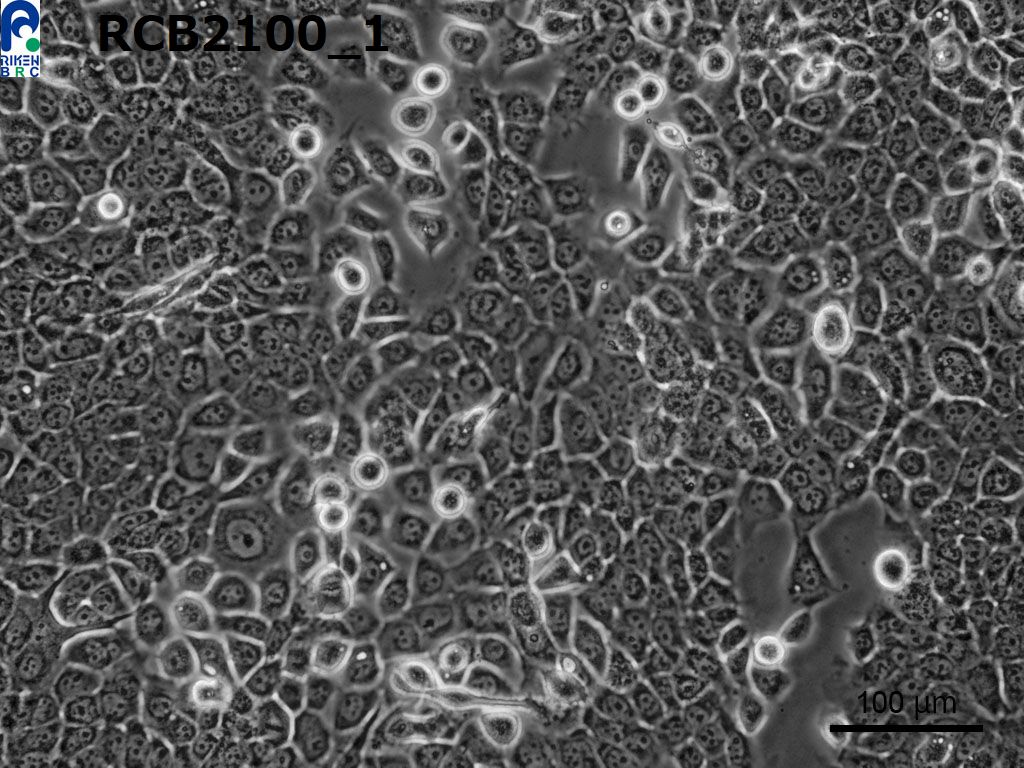 TE-11细胞图片
