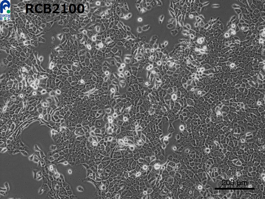 TE-11细胞图片