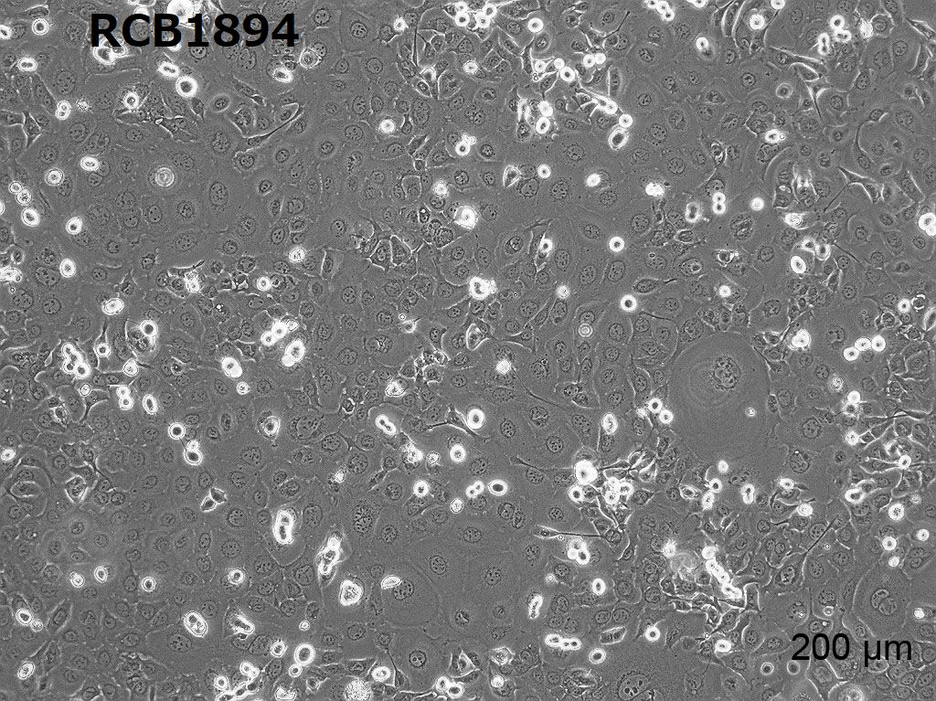 TE-1细胞图片