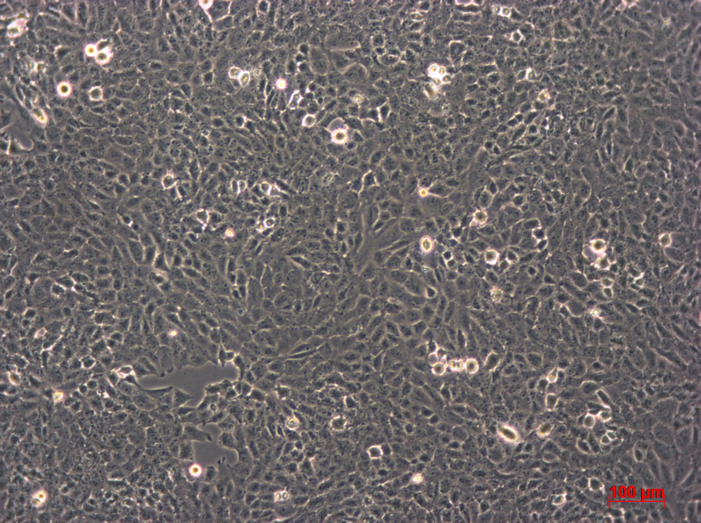 UMR-106细胞图片