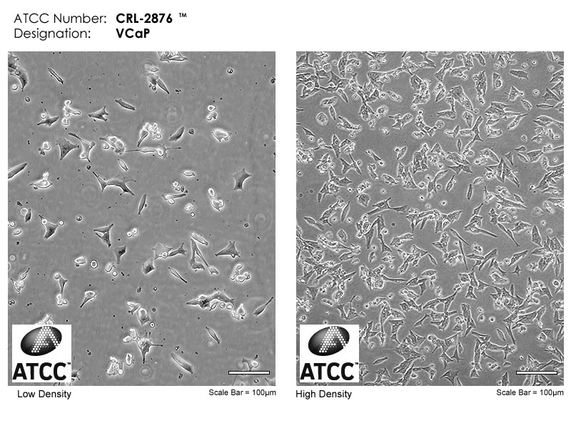 VCaP细胞图片
