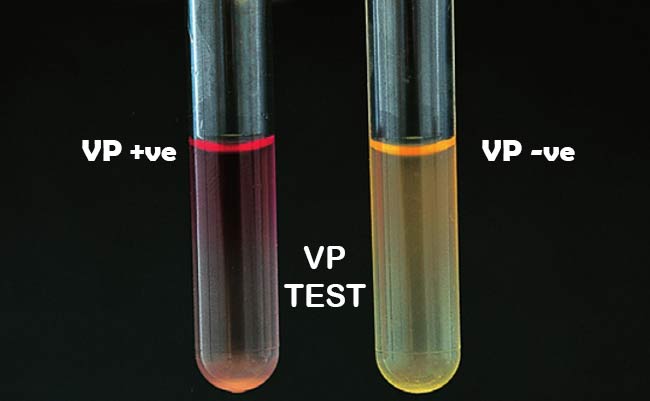 VP试验结果