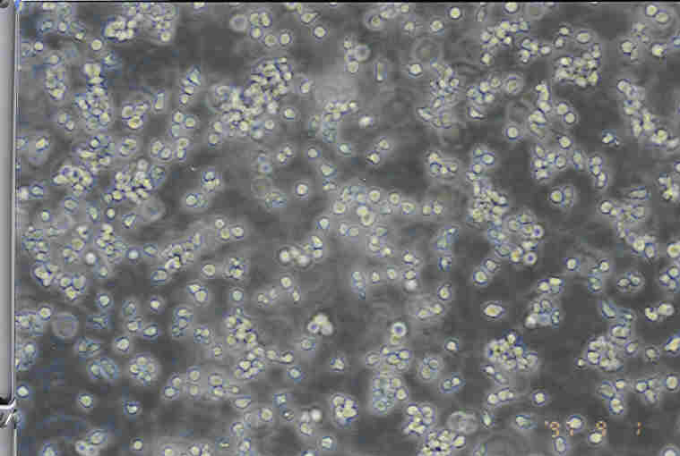 YAC-1细胞图片