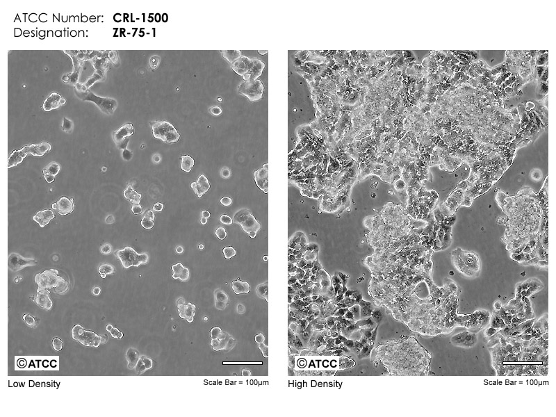 ZR-75-1细胞图片