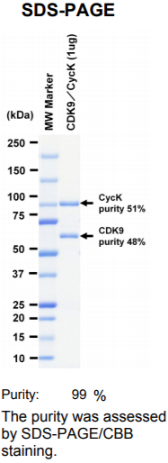 CDK9/CycK激酶蛋白
