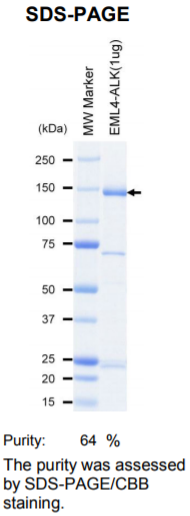 EML4-ALK激酶蛋白