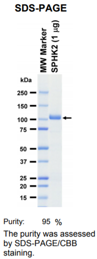 SPHK2激酶蛋白