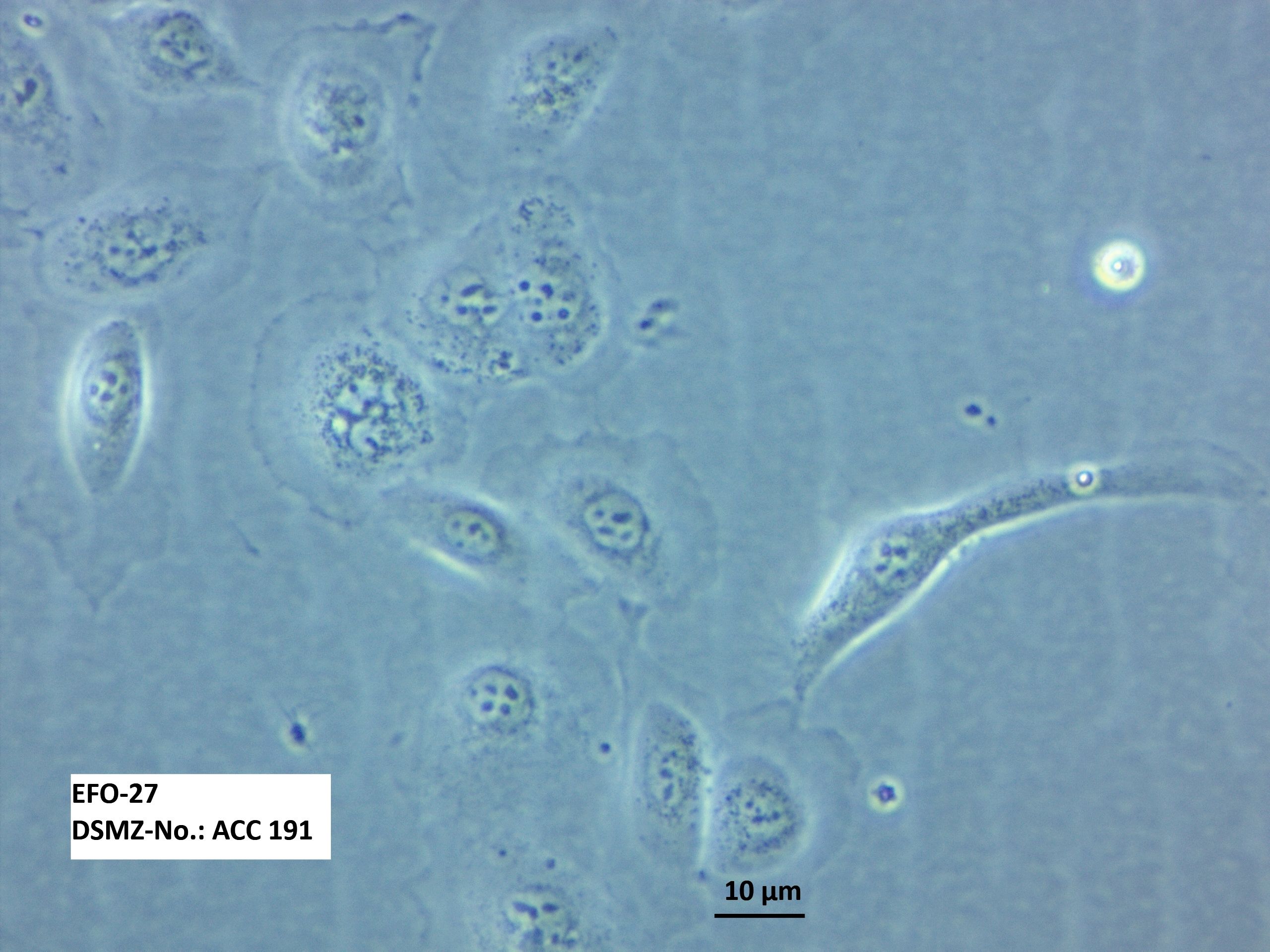 ATCC CCL-228 EFO-27细胞图片
