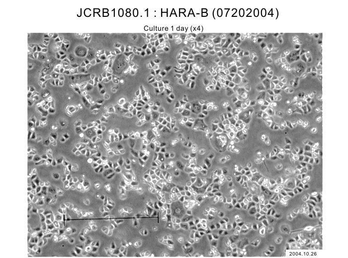 HARA-B细胞图片