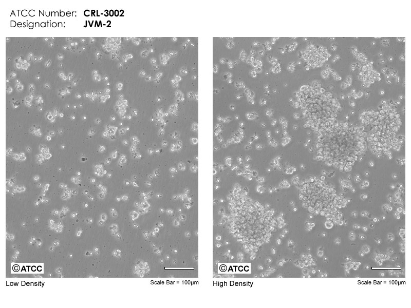 JVM-2细胞图片