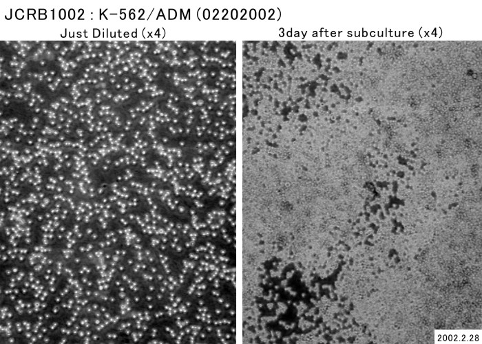 K562/ADR细胞图片