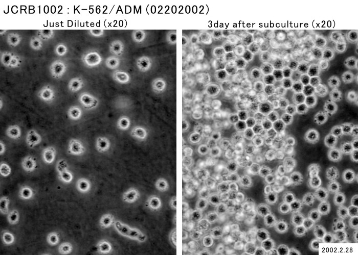K562/ADR细胞图片