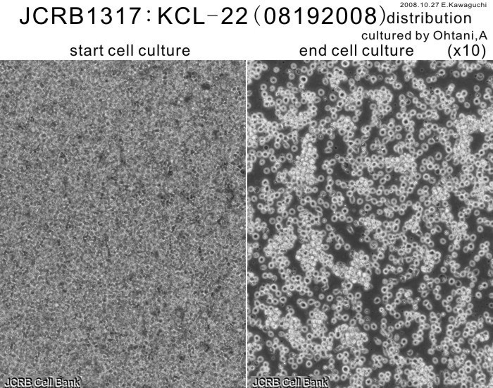 KCL-22细胞图片
