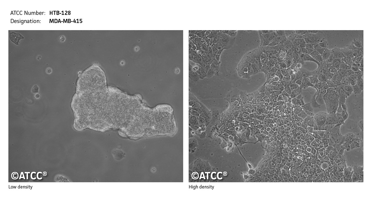 MDA-MB-415细胞图片