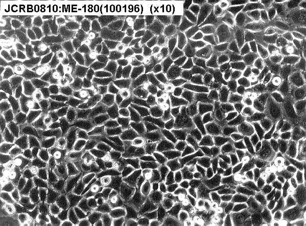 ME-180细胞图片