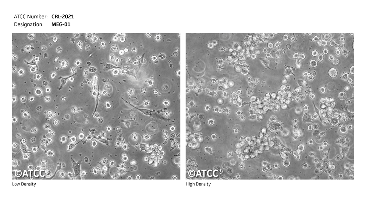MEG-01细胞图片