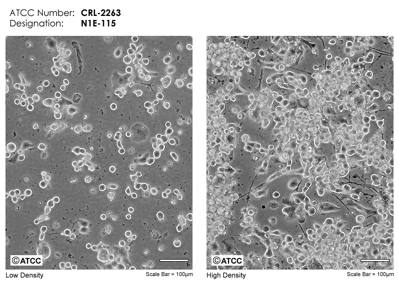 N1E-115细胞图片