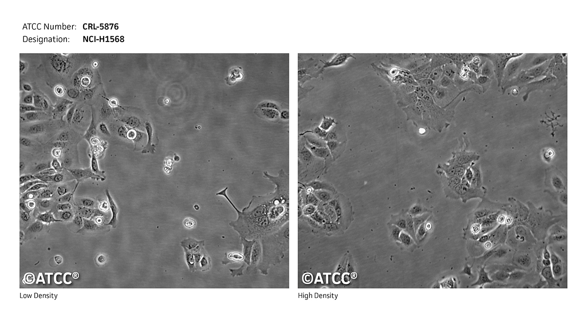 NCI-H1568细胞图片
