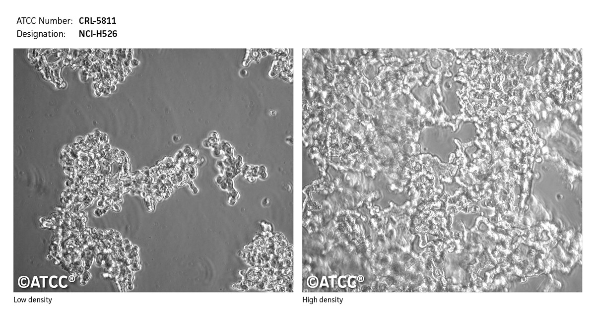 NCI-H526细胞图片