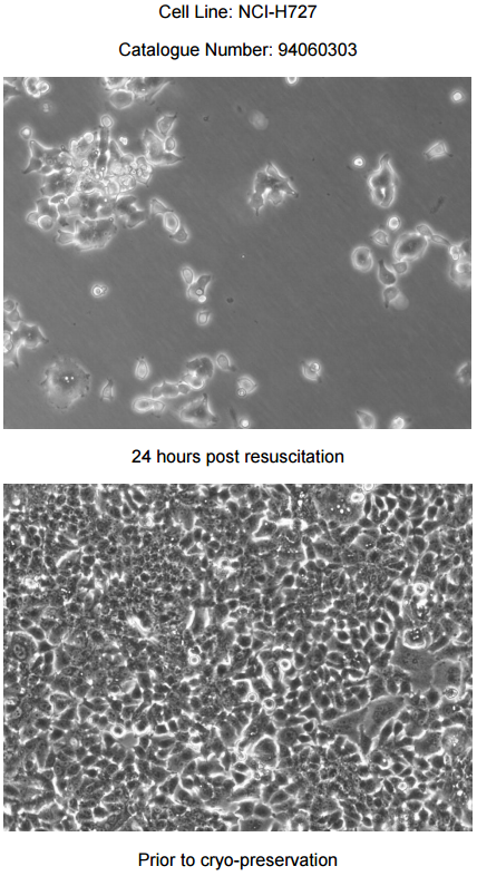 NCI-H727细胞图片