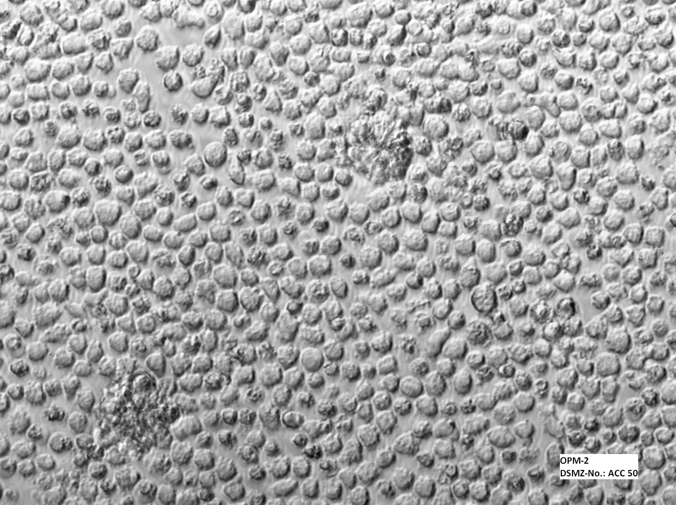 OPM-2细胞图片