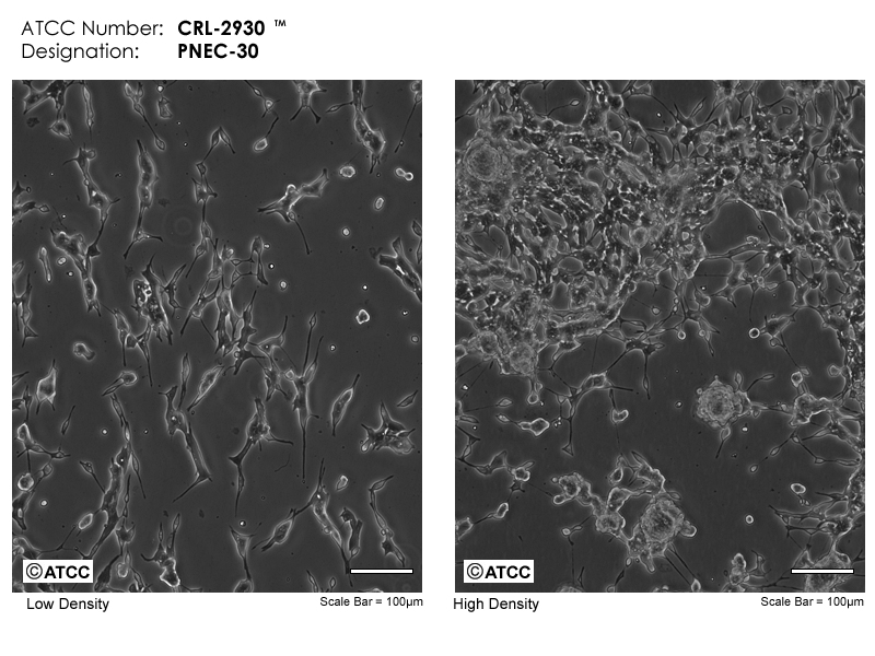 PNEC30细胞图片